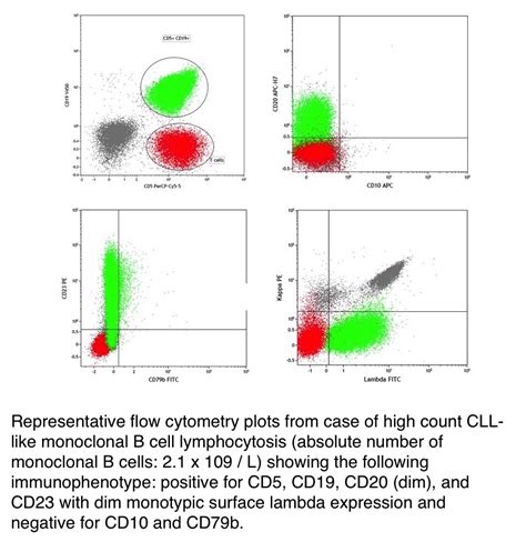 high cd19 count|Monoclonal B.